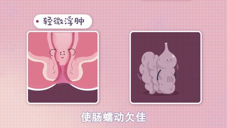 產(chǎn)后痔瘡好尷尬?快學(xué)急招預(yù)防它 55