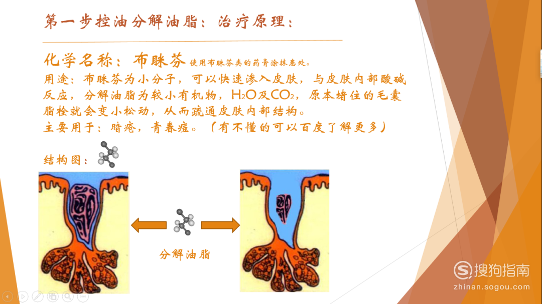 控油分解油脂,治疗原理,通过分解油脂,排除油脂,达到控油目标.