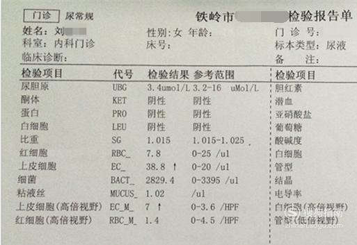 自己看懂尿常规检查单