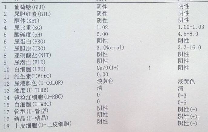 尿糖(glu)正常呈阴性,阳性临床意义为血尿增高性糖尿,血糖正常性糖尿