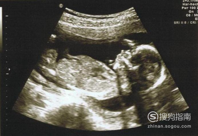 也可以胎儿的胎位,面朝外的一般是女宝宝,背朝外的一般是男宝宝
