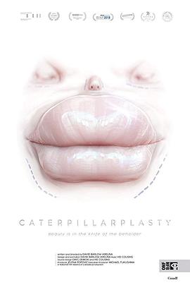 caterpillarplasty
