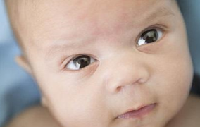 婴儿斗鸡眼怎么判断 怎么样辨别宝宝有没有对眼俗称斗鸡眼？