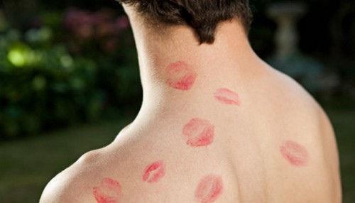 怎么才能快速消除吻痕 如何快速消除吻痕？